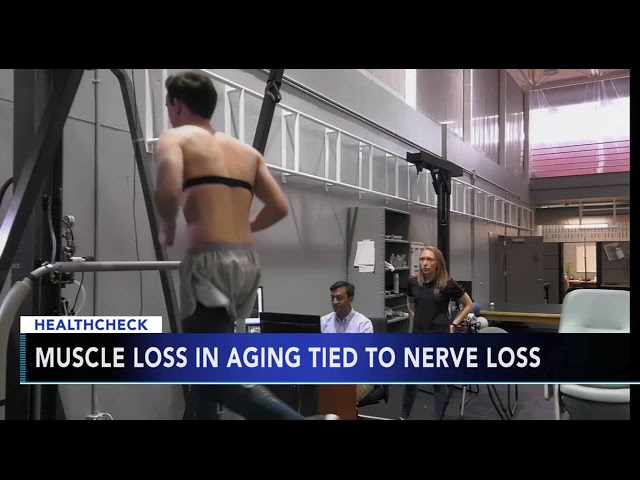 Muscle loss in aging tied to nerve loss