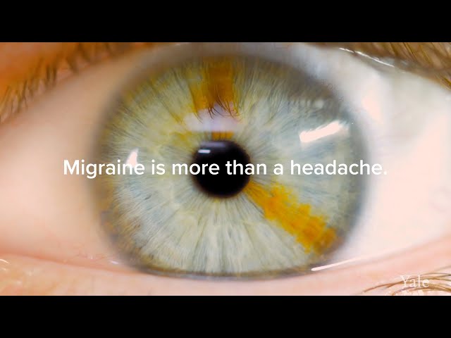 Migraine: A Neurological Condition That's Not Just in Your Head