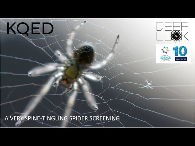 A Very Spine-Tingling Spider Screening with DEEP LOOK