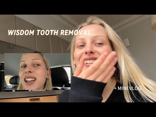 Getting back to health after traveling MINI VLOG + Wisdom tooth removal 🫣