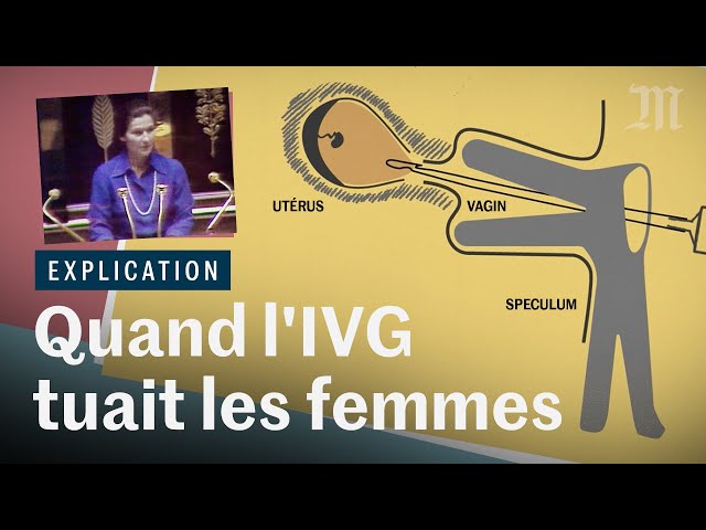 IVG dans la Constitution : quand l'avortement tuait les femmes en France