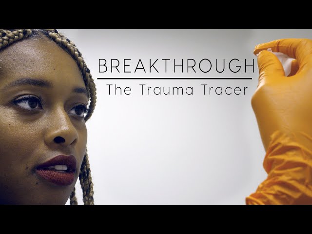 Breakthrough: The Trauma Tracer