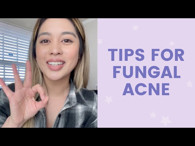 Tips for Fungal Acne | FaceTory