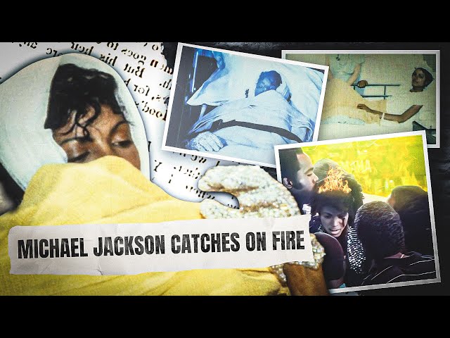 The ACCIDENT That RUINED Michael Jackson's Life