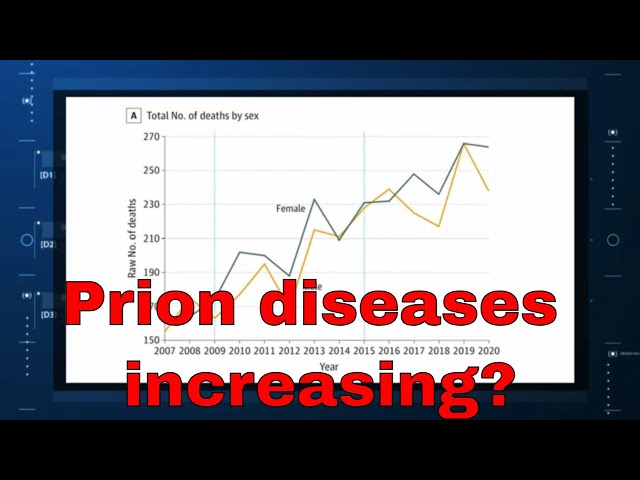 The Strange Increase in Prion Diseases