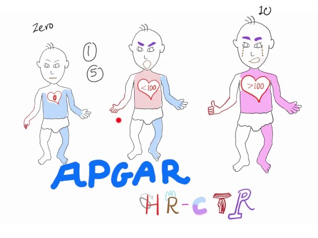 Understanding APGAR score, the best explanation with a mnemonic!