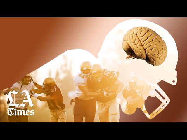 How CTE changes everything about football