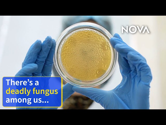 This Fungus Is Spreading Rapidly in Hospitals