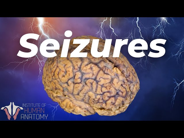 What's Actually Happening During a Seizure