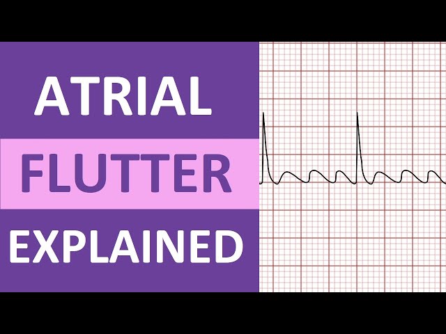 Atrial Flutter ECG: Causes, Treatment, Nursing NCLEX, ACLS Heart Rhythm Explained