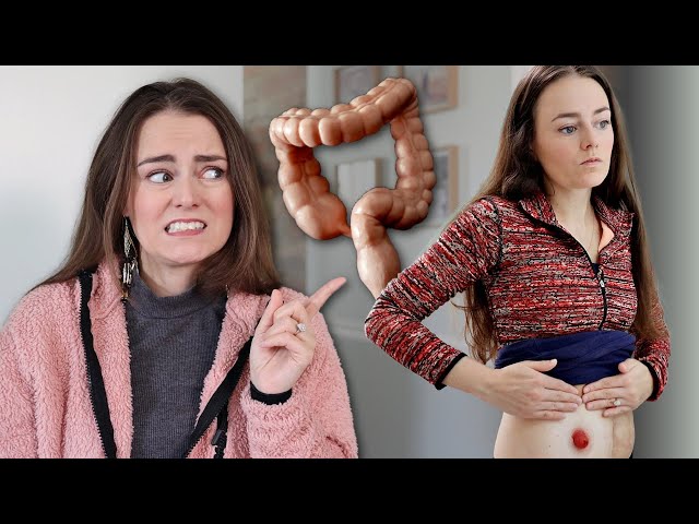 Hospitalized Because I Ignored My Detached Colon & Rectum (don't do the same!) | Let's Talk IBD