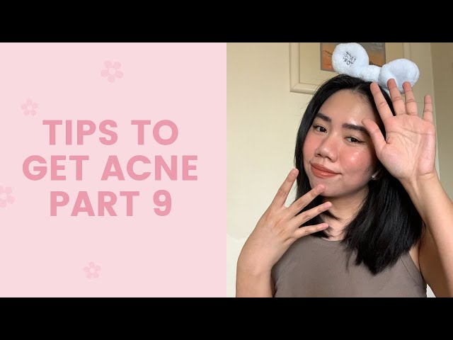 Tips to Get Acne #9 | FaceTory