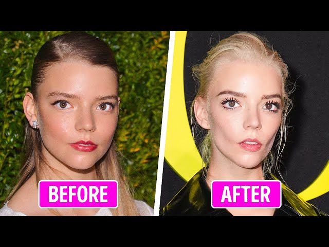 50+ Celebrities Whose Face Change Through the Time