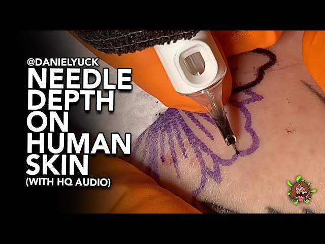 Needle Depth On Human Skin With HQ Audio