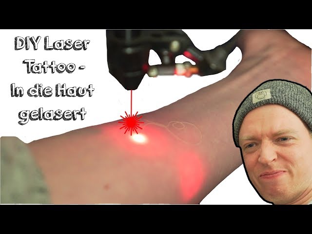 DIY Laser Tattoo - In die HAUT GELASERT | Deutsch | ultimartinum