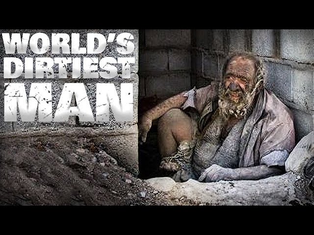 World's Dirtiest Man - He Has Not Bathed in Over 60 years