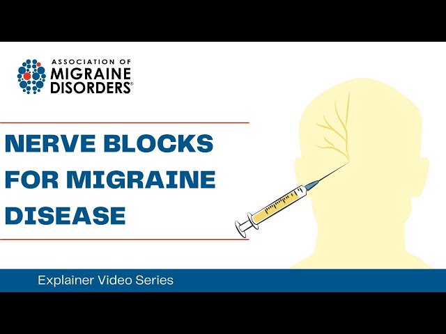 Nerve Blocks for Migraine Disease - Chapter 5: Episode 4 - Explainer Video Series