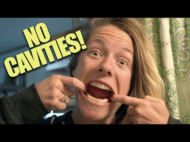NO CAVITIES after YEARS  without dentist! || NATURAL DENTAL CARE || Chronic Cavity Cure!