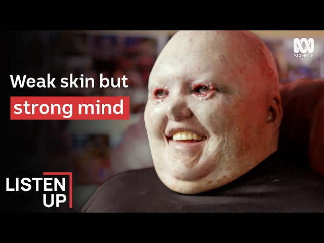 “My Skin Rips With Every Movement” | Listen Up | ABC Science