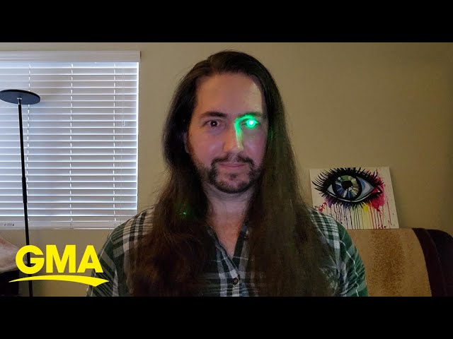 Man loses eye to cancer, turns prosthetic eye into flashlight l GMA