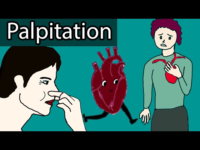Heart Palpitations - Causes, When to worry about heart palpitations?
