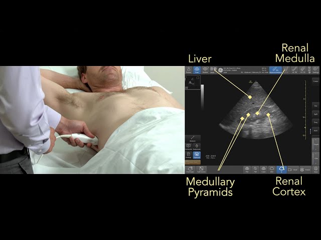 Point of Care Kidney and Bladder Ultrasound