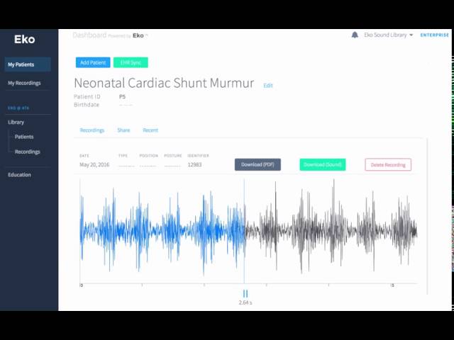Neonatal Cardiac Shunt Murmur Recording & Waveform | Eko Health
