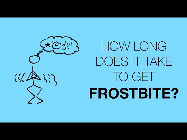 How long does it take to get frostbite?