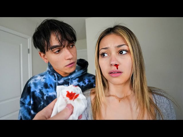 My Girlfriend gets a BLOODY NOSE, What Happens is Shocking