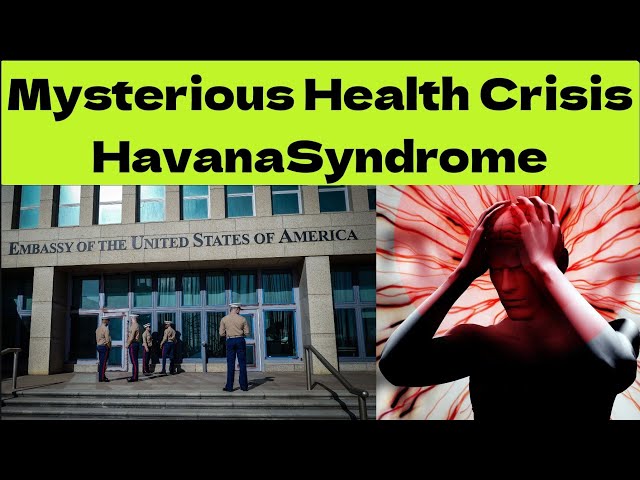Unraveling the Enigma of Havana Syndrome: Mysterious Health Symptoms and Global Concerns.