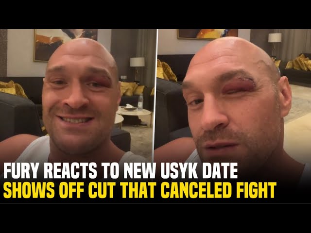 Tyson Fury Responds to Oleksandr Usyk | New Date Announced
