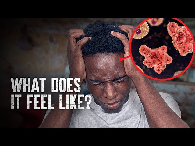 How to Survive a Brain-Eating Amoeba
