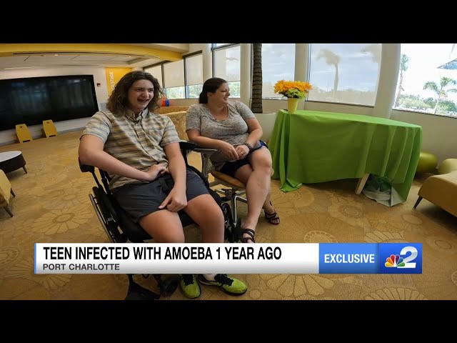 Port Charlotte teen beats brain-eating amoeba