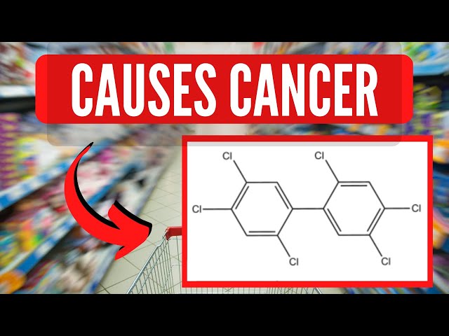 4 Common Causes Of CANCER That Most People Don’t Know About