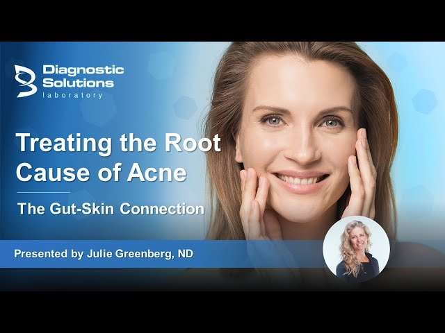 Treating the Root Cause of Acne: The Gut Skin Connection