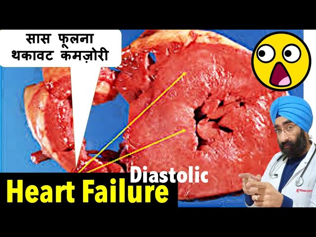क्या होता है HFpEF : Diastolic Heart Failure with Preserved Ejection Fraction | Dr.Education
