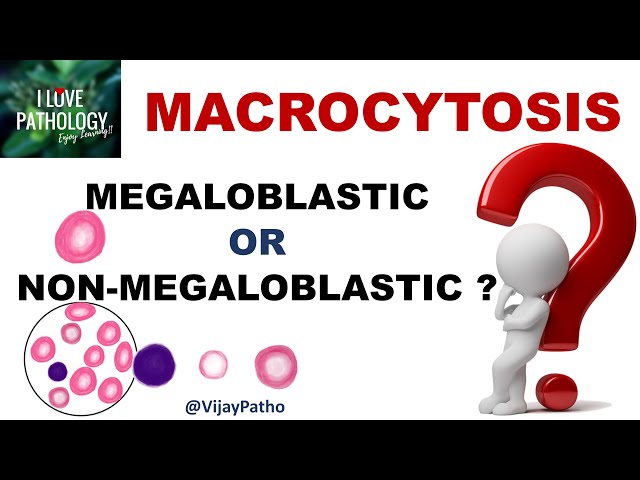 MACROCYTOSIS.   Causes, Mechanism & Approach