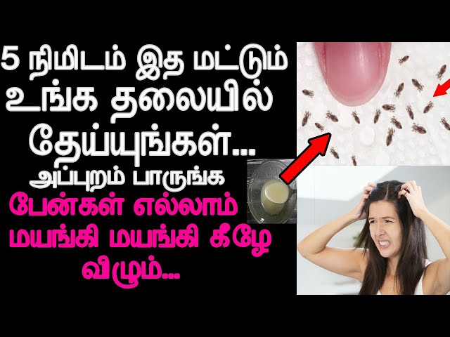 5 நிமிடம் இத மட்டும் உங்க தலையில் தேய்யுங்கள் அப்புறம் பாருங்க | Hair care in tamil