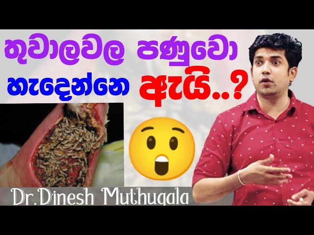 තුවාලවල😲 පණුවො හැදෙන්නෙ ඇයි ?| Dinesh muthugala sir |  Why do maggots form in wounds?