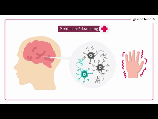 Was ist die Parkinson-Erkrankung?