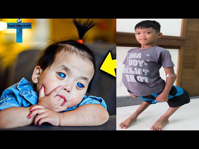 Top 10 Unusual And Amazing Kids Around The World You Won't Believe Exist