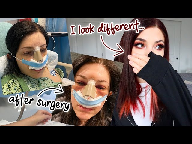 I had to get reconstructive surgery on my face... || Kelli Marissa Vlogs