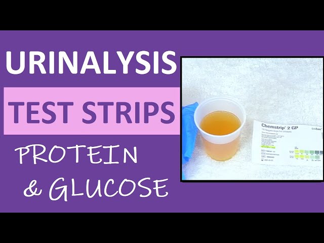 Pregnancy Urinalysis: Protein & Glucose in Urine Reagent Test Strips