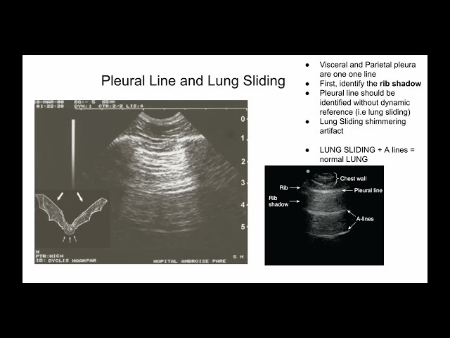 Introduction to Lung Ultrasound POCUS