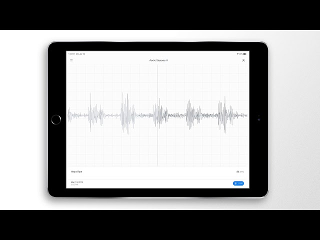 Aortic Stenosis Recording & Waveform | Eko Health
