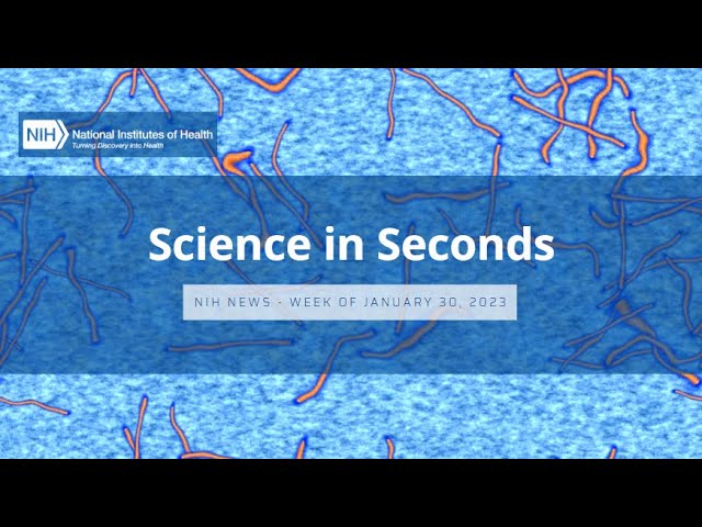 NIH Science in Seconds – Week of January 30, 2023