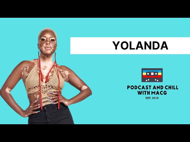 EPISODE 542 | Yolanda On Big Brother Disqualification, Language Barriers, Housemates,Family,Vitiligo