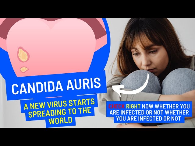 Candida Auris / A new virus starts to spread to the world /  How to survive Candida Auris?
