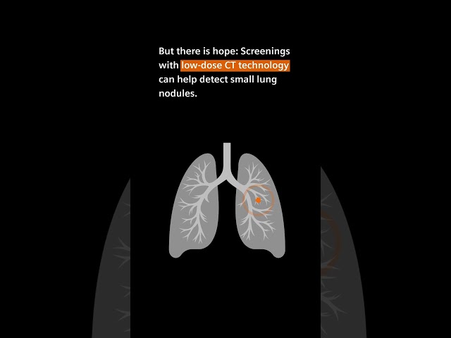 Lung cancer: Catch it while it‘s small