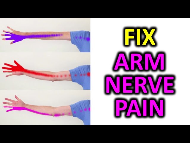 3 Exercise To Relieve Arm Pain, Numbness, Pins and Needles